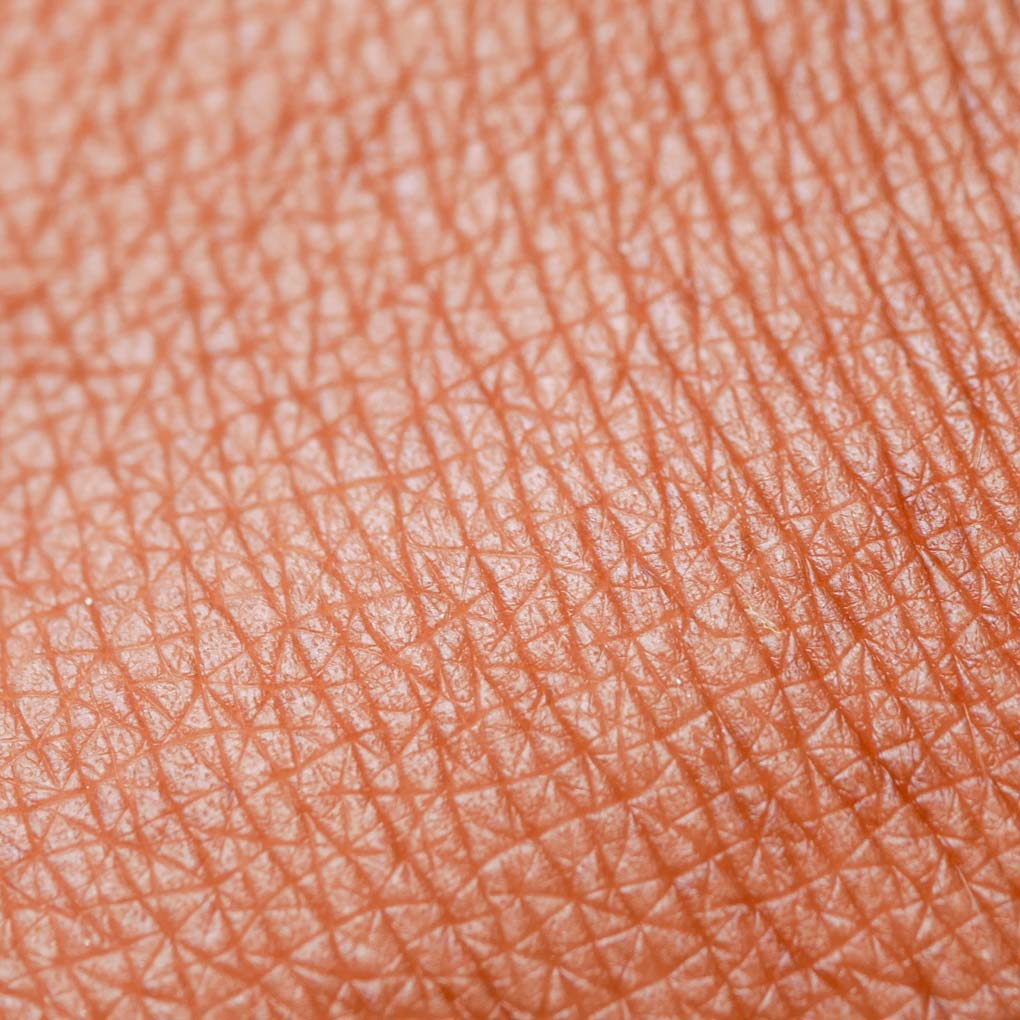 Dehydrierte Haut