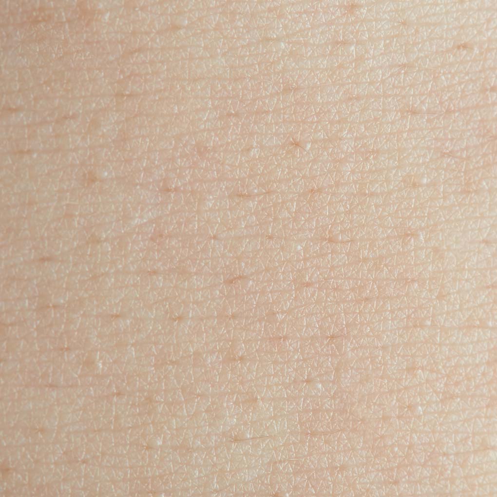 empfindliche haut
