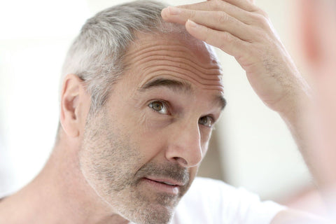 Haarausfall bei Männern: Was kann ich dagegen tun?