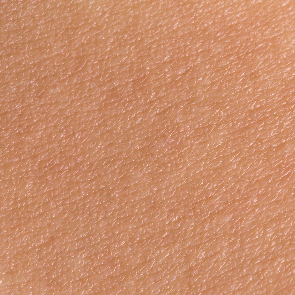 Normale Haut